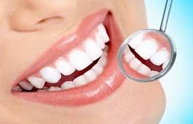 الأسنان التجميلية (ابتسامة هوليوود)